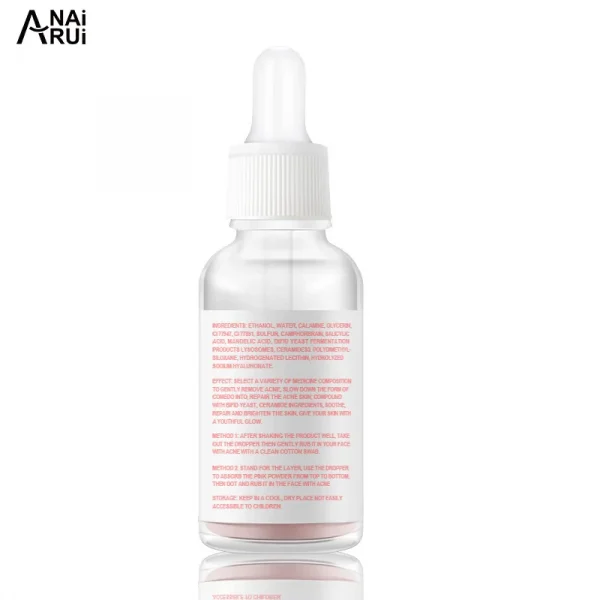 Hot selling Treatments acne scar removal acne serum Beauty drying lotion acne cream - Image 2