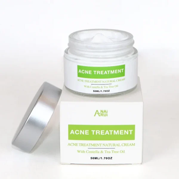 Private Label Skin Cystic Acne Treatment Cream and Acne Scar Remover Natural Acne Spot Pimple Cream - Image 2