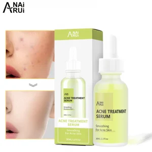 Acne Treatment Serum