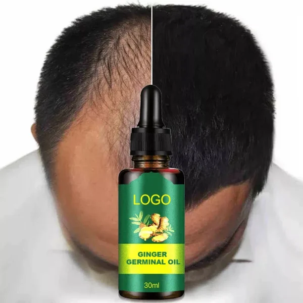 Hot sale 30ml Hair Loss Treatment Growth Oil Nutrient Solution natural organic ginger hair growth essence 7 days for man woman - Image 2