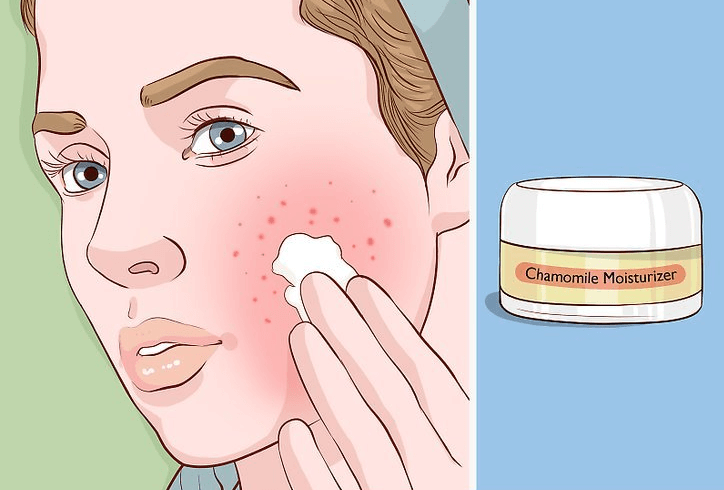 skin at home