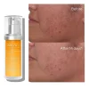 Private Label Rapid Dark Spot Correcting Serum Daily Brightening Soothing Dark Spot Facial Serum - Image 2