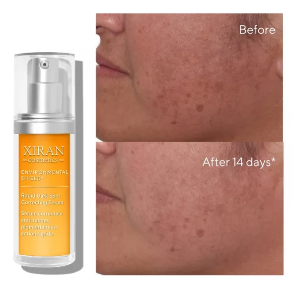 Private Label Rapid Dark Spot Correcting Serum Daily Brightening Soothing Dark Spot Facial Serum - Image 2