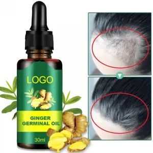 Hot sale 30ml Hair Loss Treatment Growth Oil Nutrient Solution natural organic ginger hair growth essence 7 days for man woman