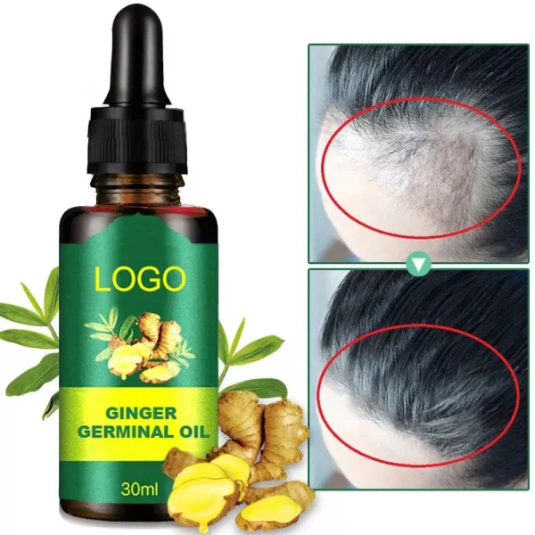 Hot sale 30ml Hair Loss Treatment Growth Oil Nutrient Solution natural organic ginger hair growth essence 7 days for man woman