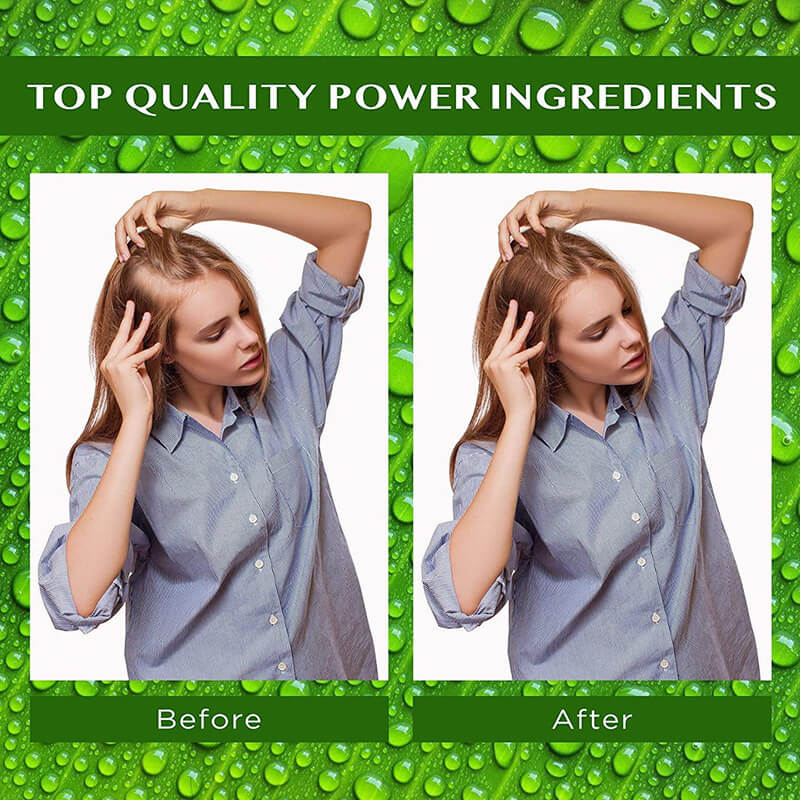 growth oil natural hair