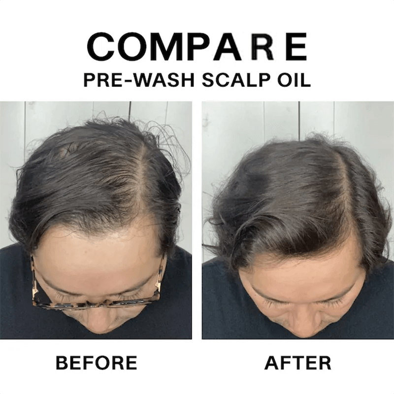 Hair Growth Oil