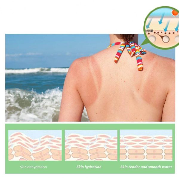 After-sun skin repair