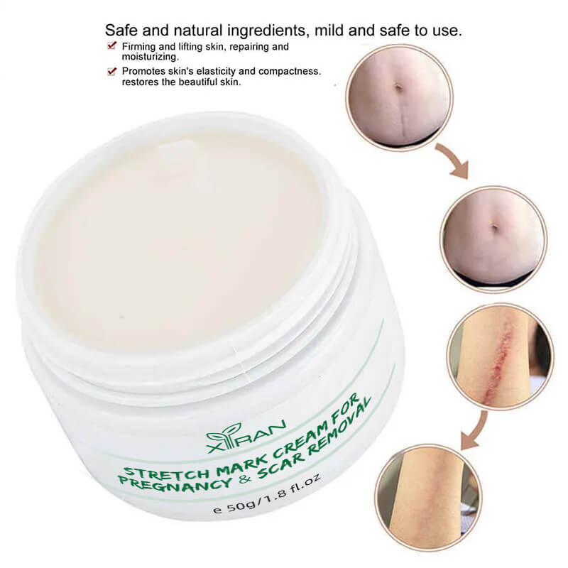 private label belly body butter pregnancy marks maternity stretch mark cream