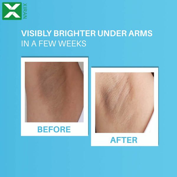 Best spray for skin brightening.