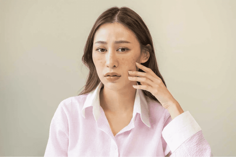 how do dark spots arise