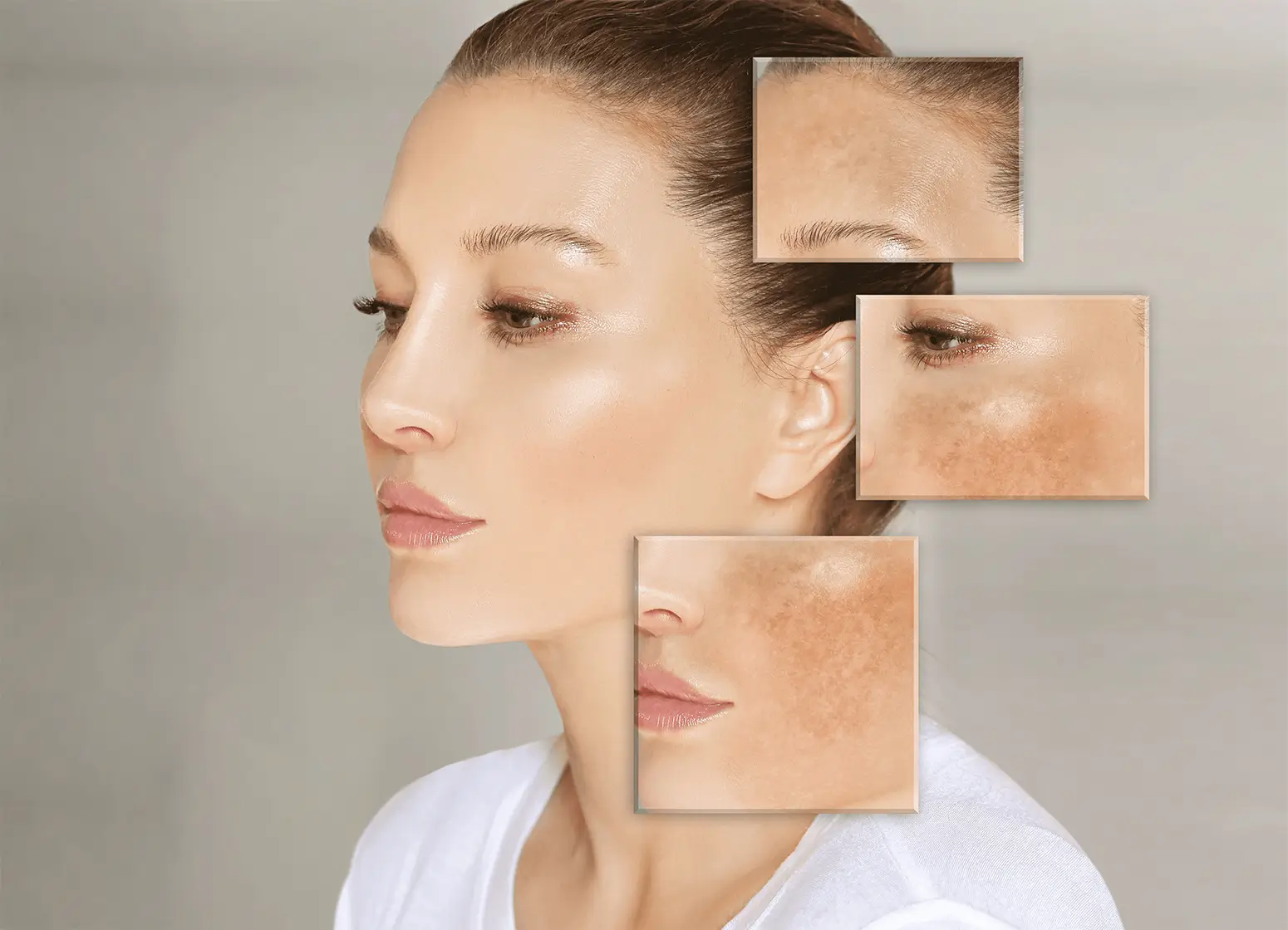 unique trend of dark spot removal products