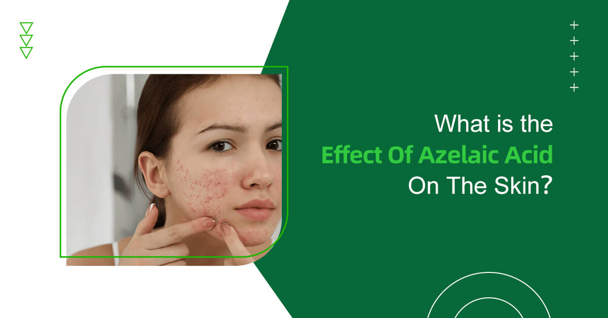 Effect Of Azelaic Acid on skin