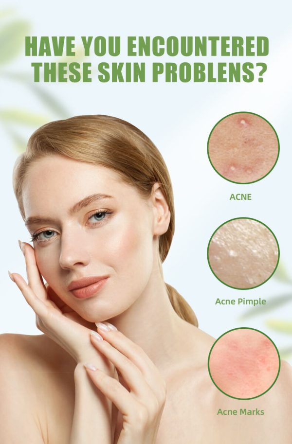 Centella Asiatica is well known for its skin-calming effect.