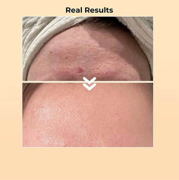 Snail Mucin Luxury Cosmetics and Skincare