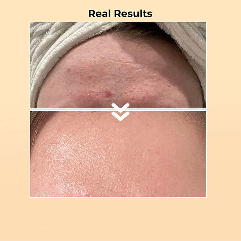 Snail Mucin Luxury Cosmetics and Skincare