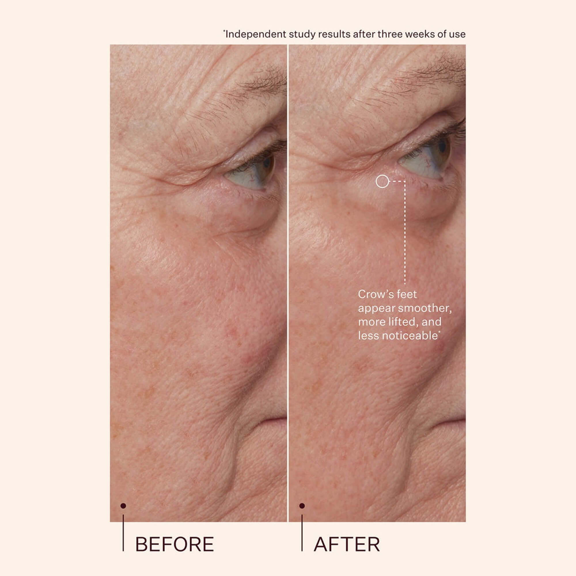 Copper peptides have many benefits for skin