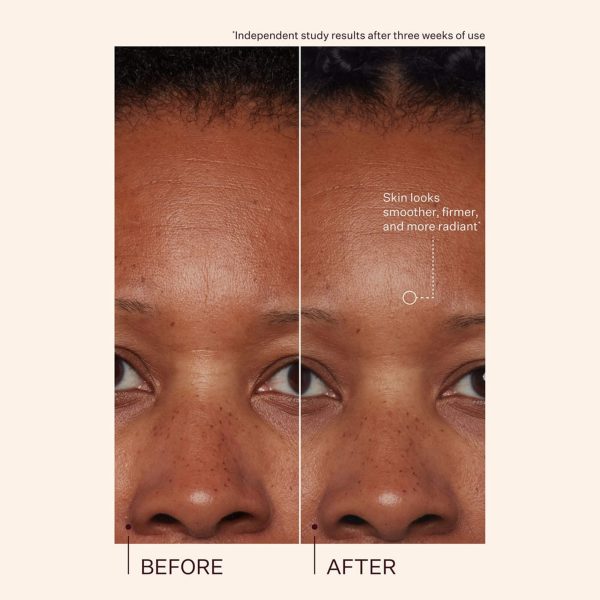 visibly plumps skin and reduces the appearance of fine lines and deep wrinkles