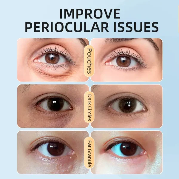 Lip And Eye Mask Set Before and After