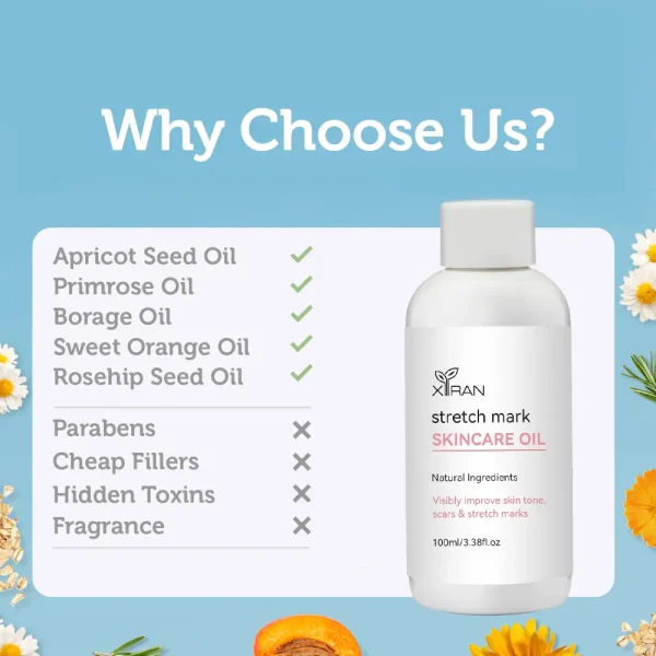 Why choose us