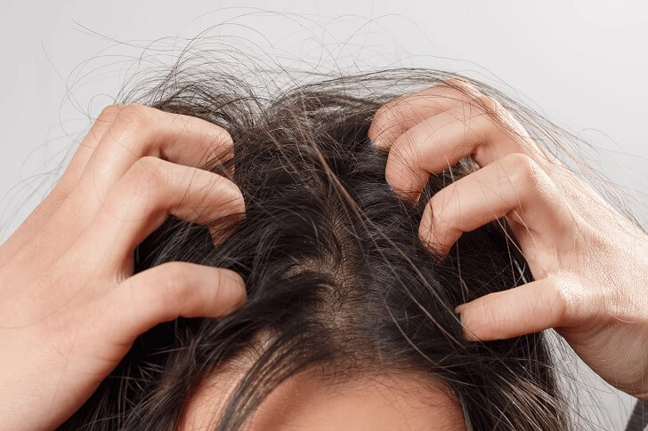 oem scalp care