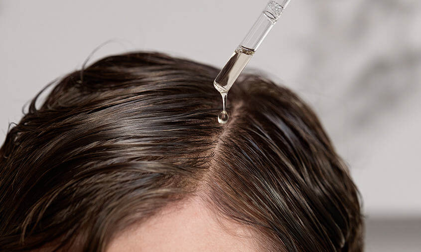 scalp care