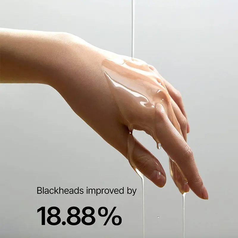 black head remover