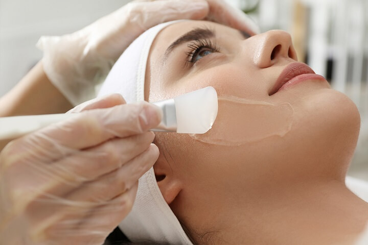 light acid skin peeling