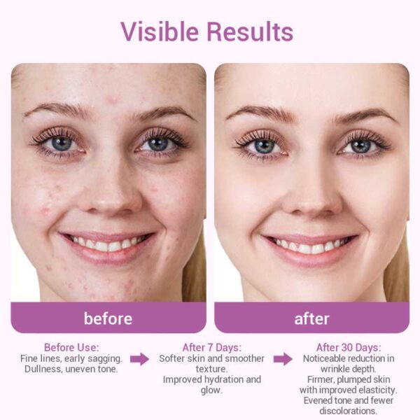 private label bakuchiol serum​