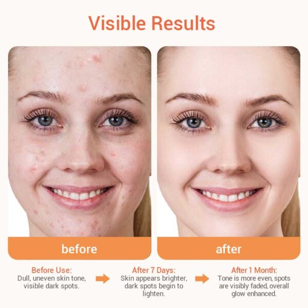 private label vitamin c serum