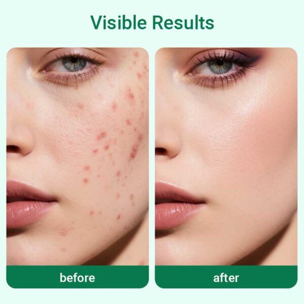 private label blemish solution facial gel