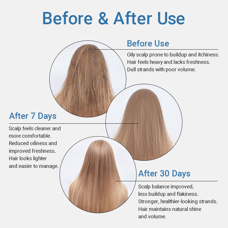 private label microbiome balance purifying scalp shampoo