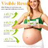 private label stretch mark removal kit