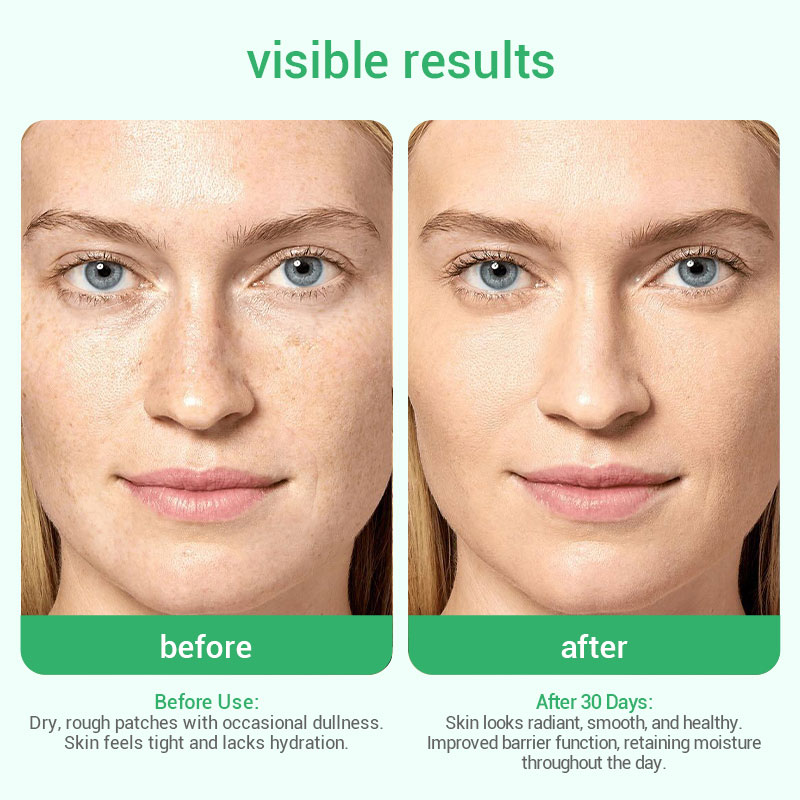 private label revision hydrating serum