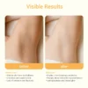 Before and after comparison of skin showing improved tone and texture with visible results.