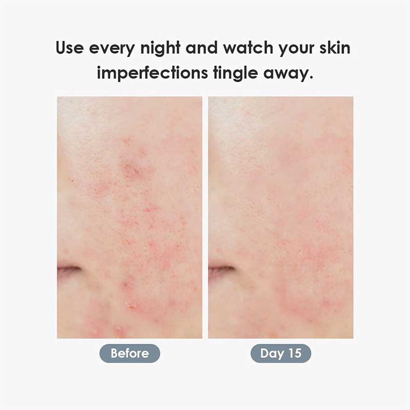 private label pdrn face cream