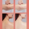 Side-by-side before and after images showing skin improvement on an arm and neck, highlighting treatment results.