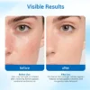Side-by-side comparison showing skin condition before and after skincare treatment, highlighting reduced redness and smoother texture.