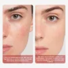 Close-up comparison of skincare results showing a woman's face before and after treatment. Before image displays redness and dryness; after image shows smoother, hydrated complexion.