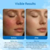 Side-by-side comparison of skin before and after use of a product, with descriptive text explaining visible improvements in texture and resilience.