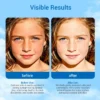 Side-by-side comparison of before and after results of a skin care product showing improved skin condition with descriptions of changes.