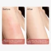 Comparison of skin condition before and after treatment, showing reduced redness and improved smoothness.