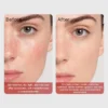 Side-by-side before and after images showing visible improvement in skin redness and hydration after skin treatment.