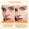 Close-up of a person's face with visible uneven skin tone, dark spots, and post-acne marks labeled 'before use' on an orange panel.