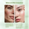 Side-by-side skin comparison showing visible improvement in pore size, oil control, and reduced blackheads with descriptive text.