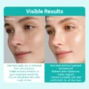 Side-by-side comparison showing skin before and after treatment, highlighting a reduction in redness, irritation, and improved texture.