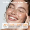 Smiling woman with glowing skin showcasing visible improvements, featuring statistics for increased brightness, smoothness, reduced dark spots, and post-acne marks fading.