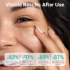 Close-up of a woman's face applying skincare product with her finger, showcasing visible improvements in skin moisture, recovery, redness, and elasticity.