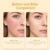Side-by-side before and after comparison showing skin transformation from dry and red to hydrated, smooth, and radiant.