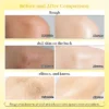 Side-by-side comparison of rough and dull skin before and after treatment, showing smoother, even-toned results.